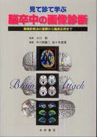 見て診て学ぶ脳卒中の画像診断